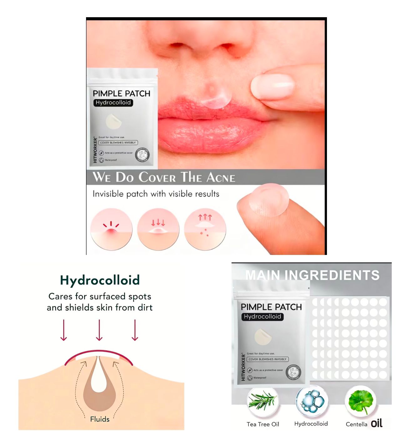 Hitworker Hydrocolloid Pimple Patches - 360 Pieces Acne Spot Treatment with Tea Tree color option