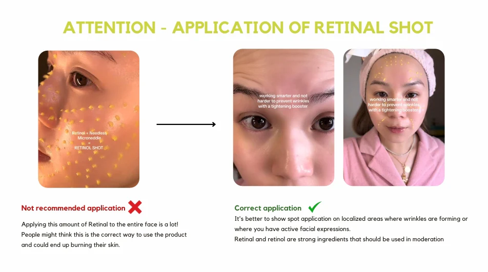 سێلیماکس بووستەری ڕێتیناڵ + Vita-A Retinal Shot بۆ سافکردنی پێست و کەمکردنەوەی کونەکان و هێڵە وردەکان + 15 مل